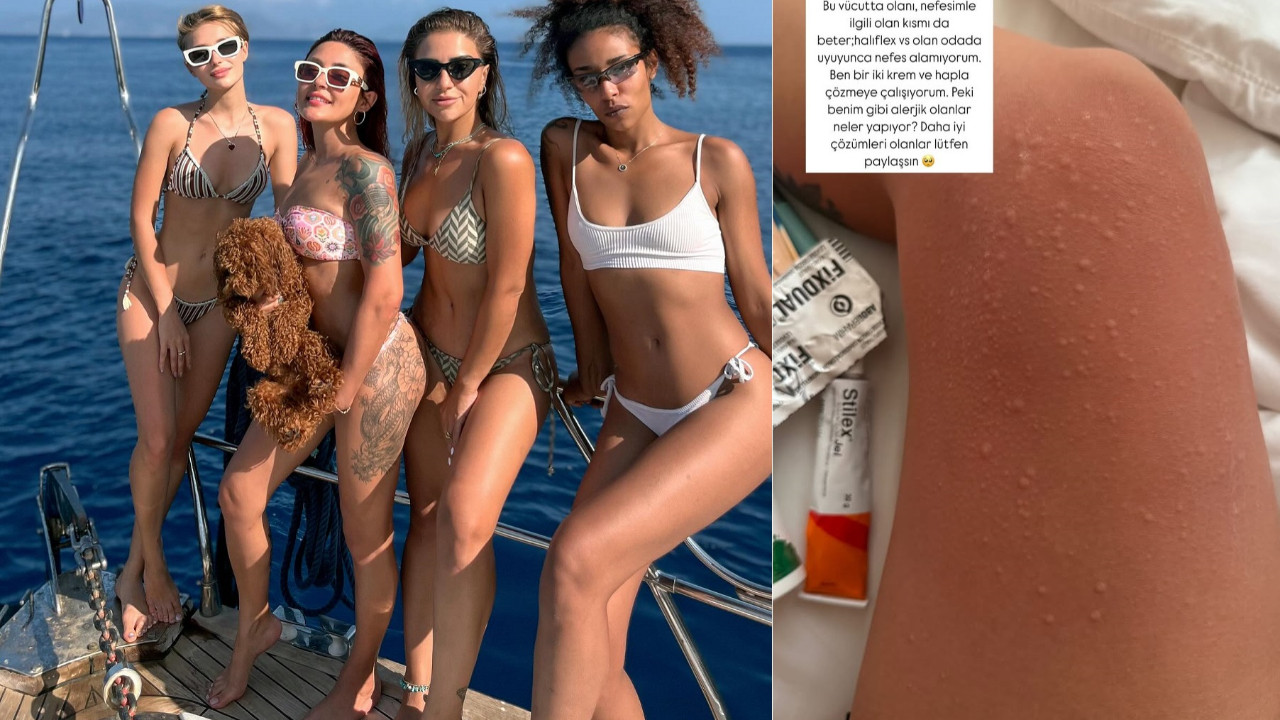 Melek Mosso makyajsız fotoğrafına gelen yorumlara isyan etti