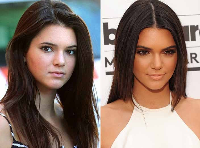 kardashian ve jenner ailesinin estetik sonrasi degisimleri medyafaresi com mobil
