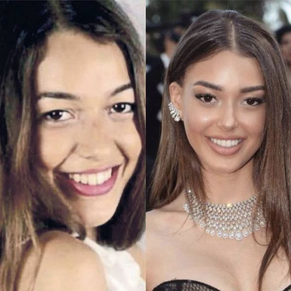 Dilan Çiçek Deniz�in eski hali şaşırttı