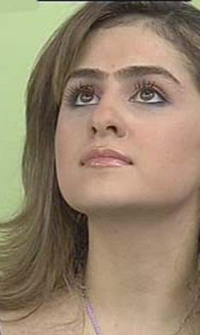 Azeri kızı Günel�in inanılmaz değişimi Eski halinden şimdi eser yok