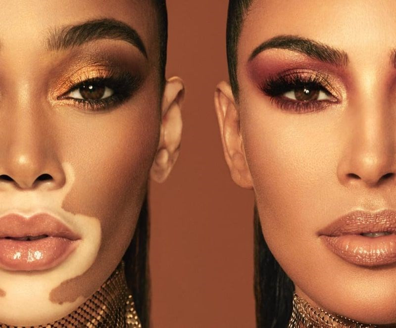 Kim Kardashian Ile Winnie Harlow Reklam Icin Bir Arada Medyafaresi Com Mobil