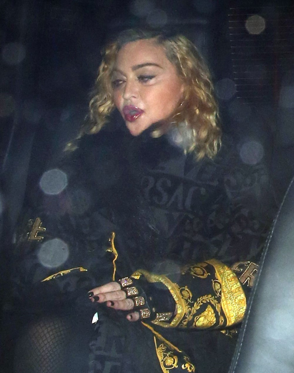 Madonna’nın son hali Hastalık mı, estetik mi?