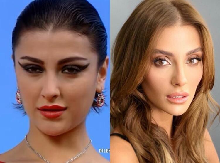 özge özder eski hali
