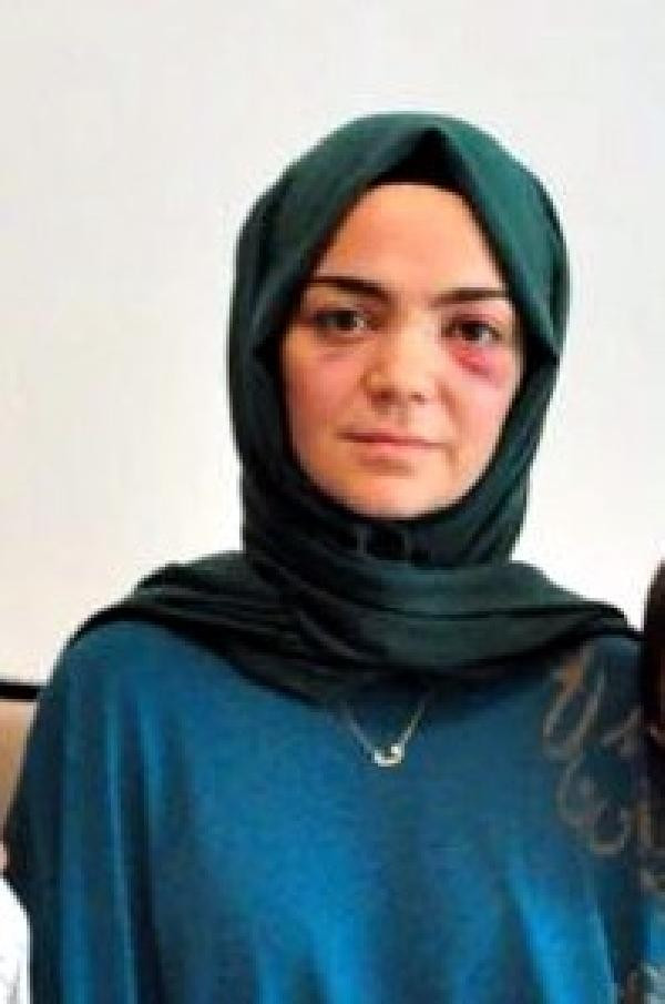 Almanya'da Türk kadını Pis Müslüman deyip yumruklayan saldırgan Rus çıktı - Resim: 1