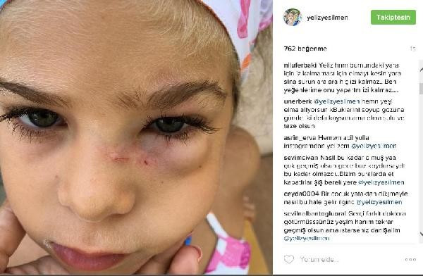 Yeliz Yeşilmen, kızı için instagramdan çözüm arıyor - Resim: 1