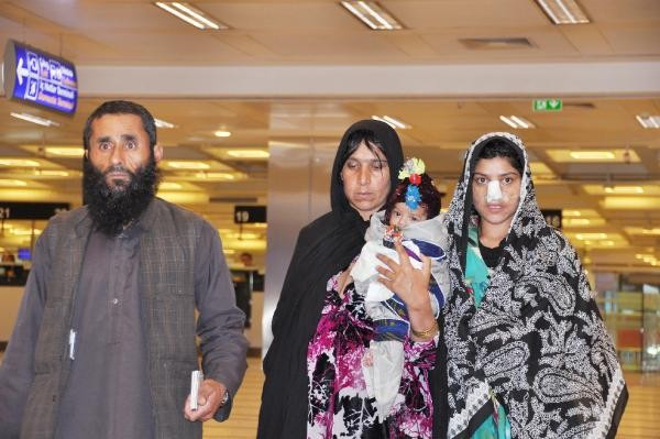Kocasının burnunu kestiği Afgan kadın tedavi için Türkiye'ye geldi - Resim: 1