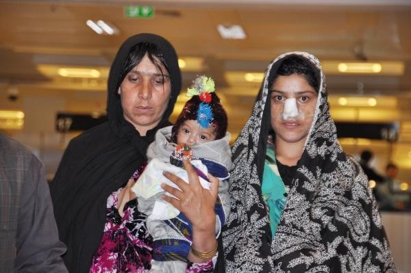 Kocasının burnunu kestiği Afgan kadın tedavi için Türkiye'ye geldi - Resim: 5