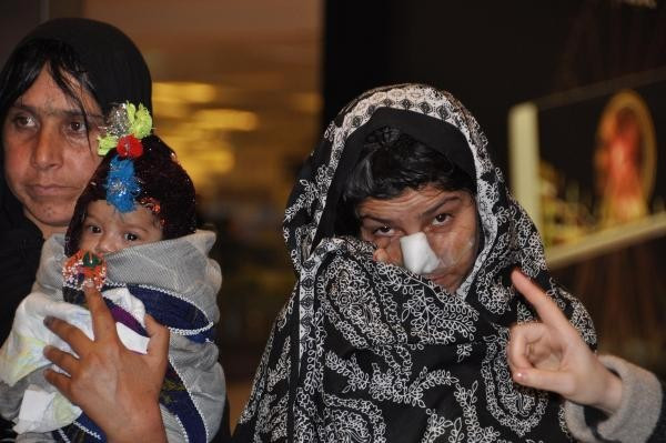 Kocasının burnunu kestiği Afgan kadın tedavi için Türkiye'ye geldi - Resim: 7