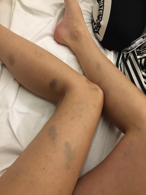 Sırp model Tanja Dukiç'e Türk sevgili dayağı: Bacaklarıma vurdu, altıma işedim, kulağımdan kan geldi - Resim: 1