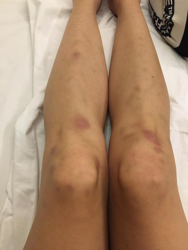 Sırp model Tanja Dukiç'e Türk sevgili dayağı: Bacaklarıma vurdu, altıma işedim, kulağımdan kan geldi - Resim: 7