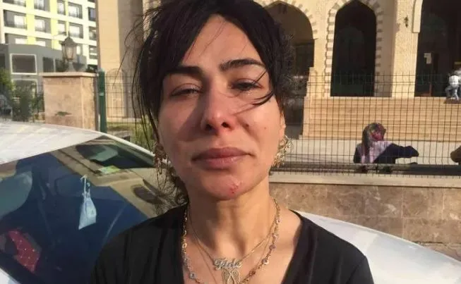 Bir Kaç Kez Merhaba Dediği Adam Hayatını Kabusa Çevirdi