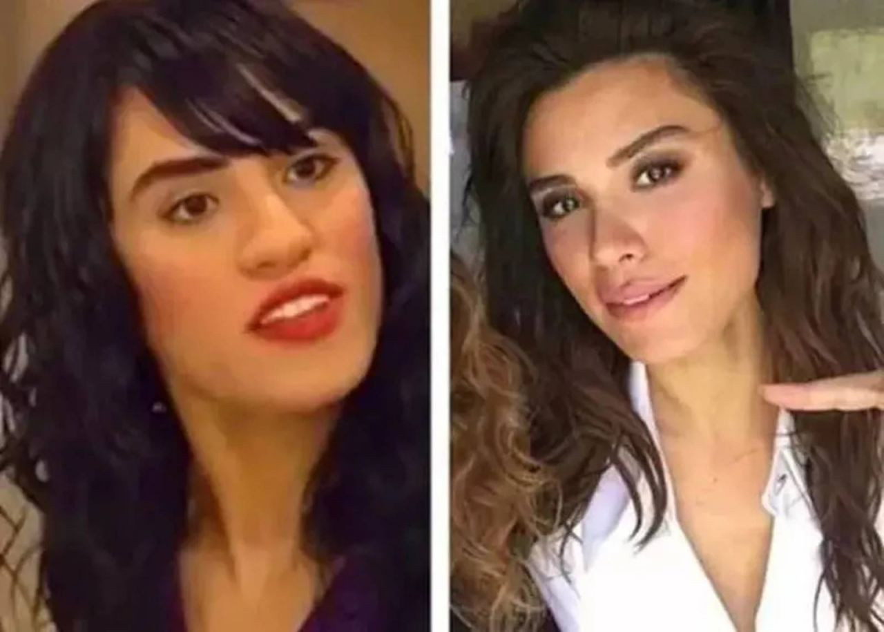 Yargı'nın Derya Savcı'sı Şükran Ovalı Estetiksiz Haliyle Şaşırttı