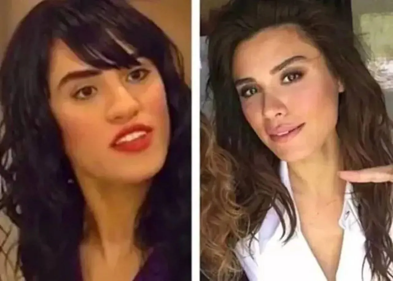 Yargı'nın Derya Savcı'sı Şükran Ovalı Estetiksiz Haliyle Şaşırttı
