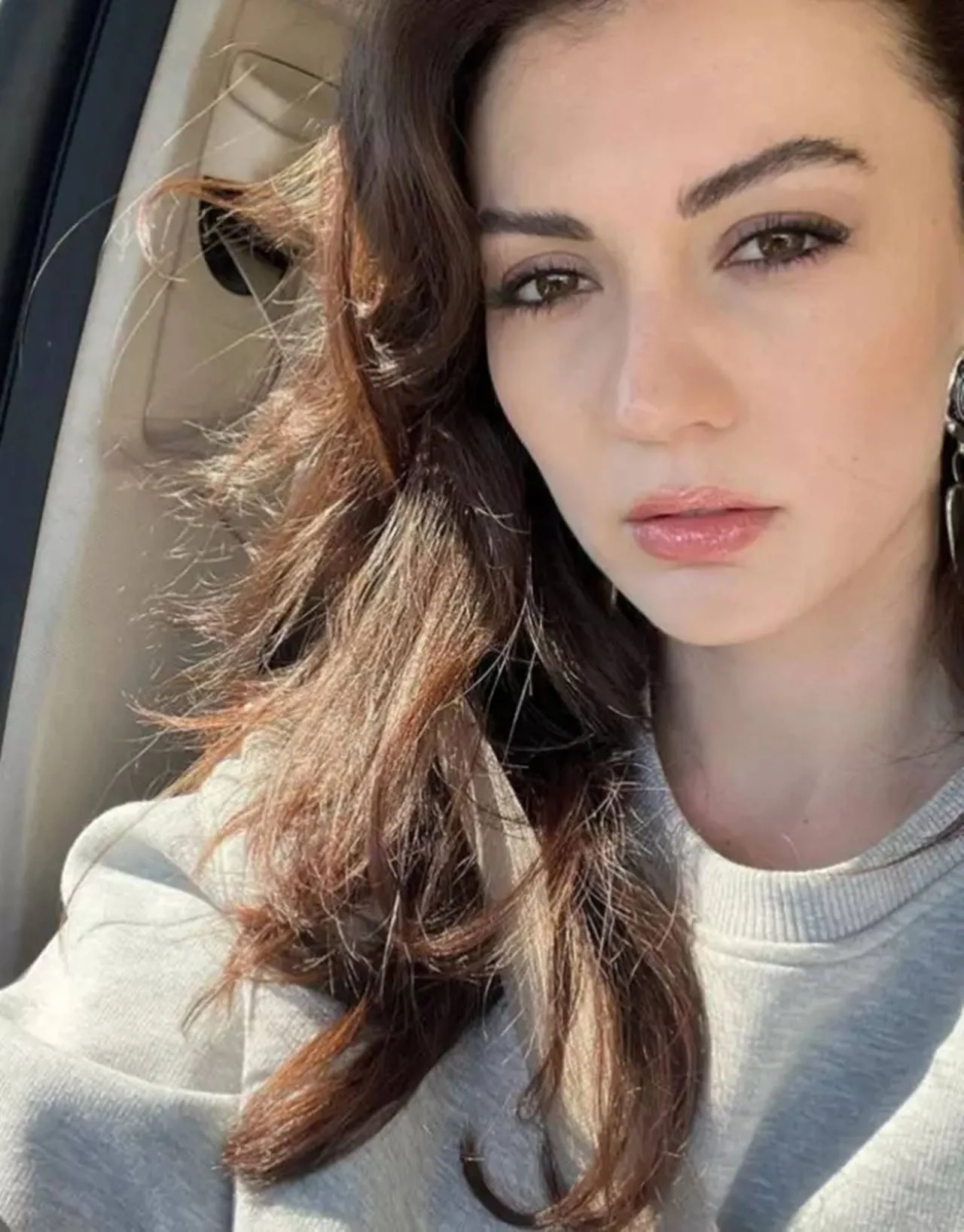 Burcu Özberk'in estetiksiz hali olay oldu