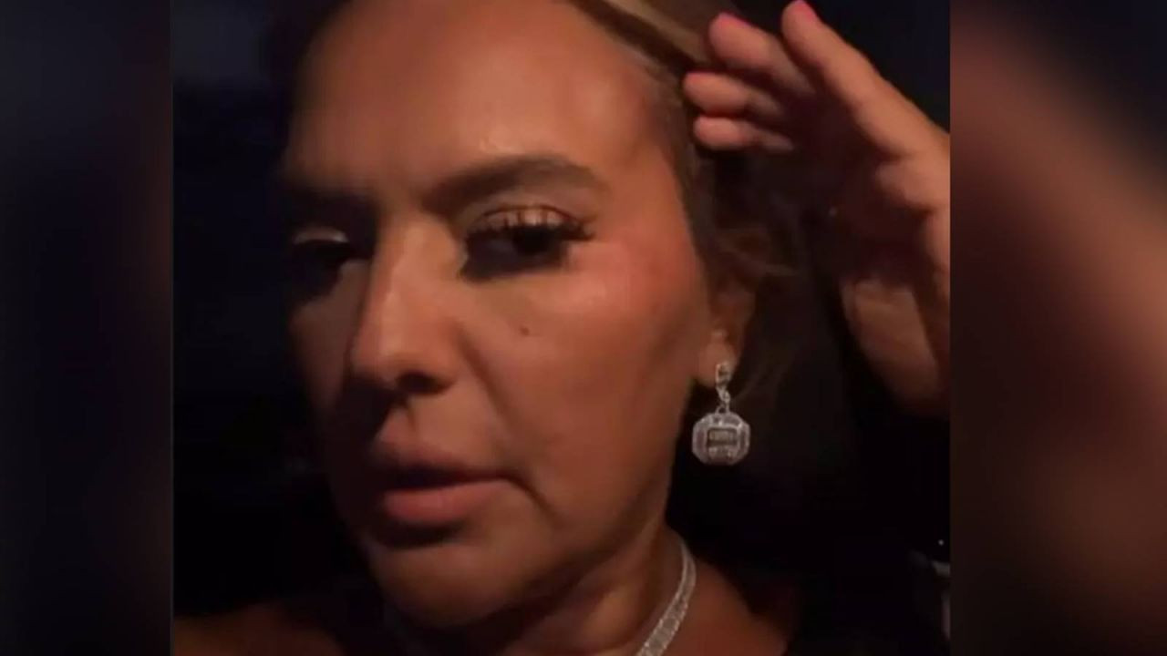 Didim'deki konserine gitmek için yola çıkan Demet Akalın kaza geçirdi