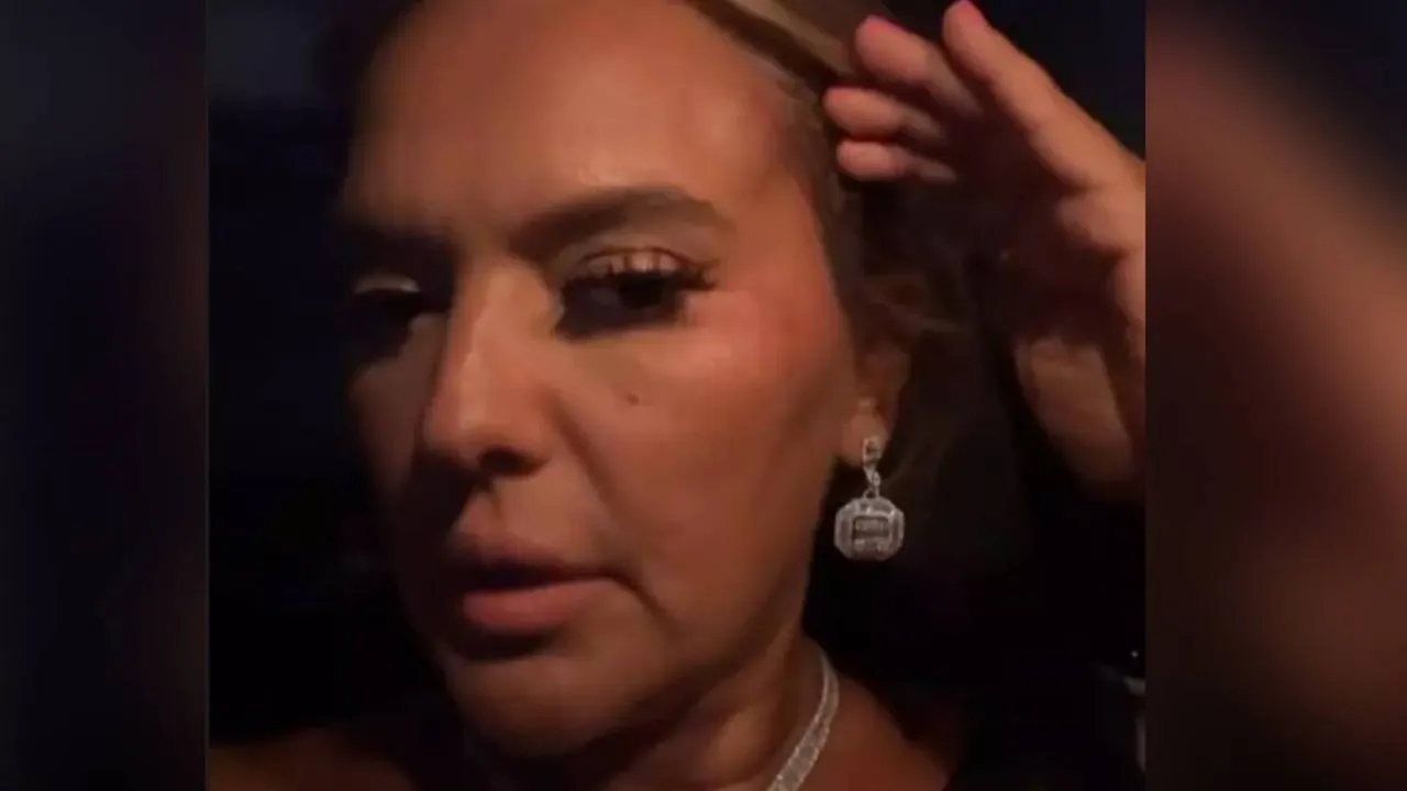 Didim'deki konserine gitmek için yola çıkan Demet Akalın kaza geçirdi