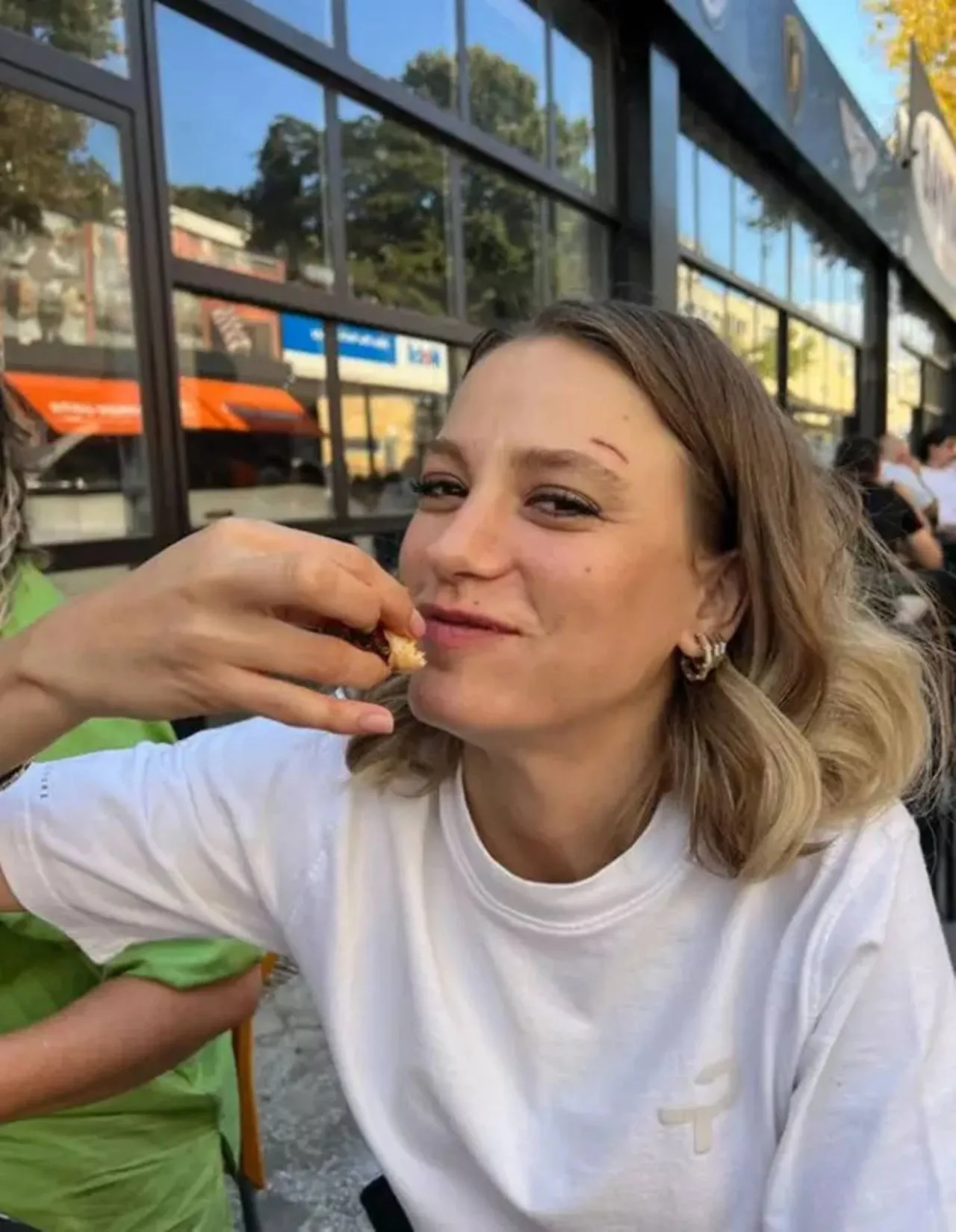 Serenay Sarıkaya hayranlarını korkuttu! Kaşımdaki yara...