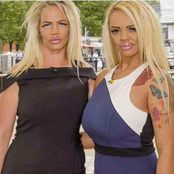 Anne kız Katie Price’e benzemek için estetik oluyorlar