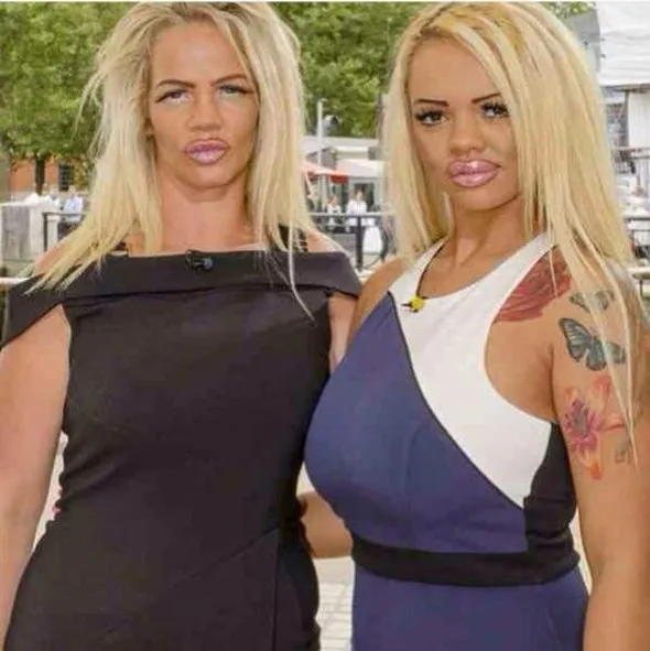 Anne kız Katie Price’e benzemek için estetik oluyorlar