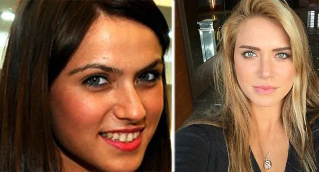 Esra Erol'un estetiksiz haline bakın sanki bambaşka biri