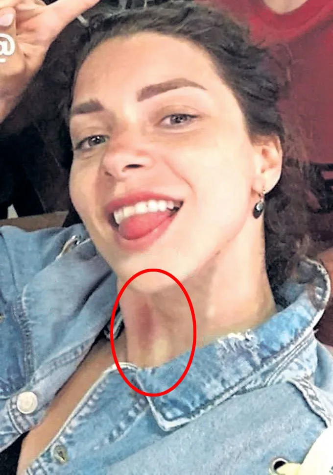Merve Boluğur üzüntüden saçkıran oldu