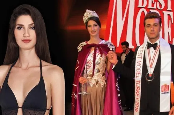 Best Model of Turkey 2016 birincisinden burun estetiği
