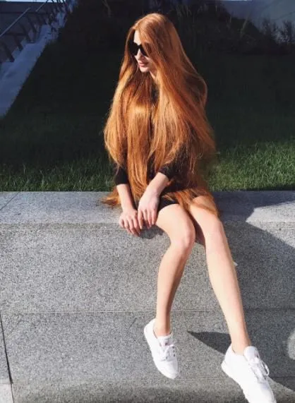 Gerçek bir Rapunzel: Yıllarca kel olan genç kadının son hali...