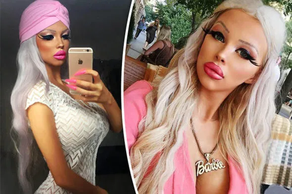 Ameliyatlı Barbie'nin 5 yıl önceki fotoğrafını görenler inanamadı
