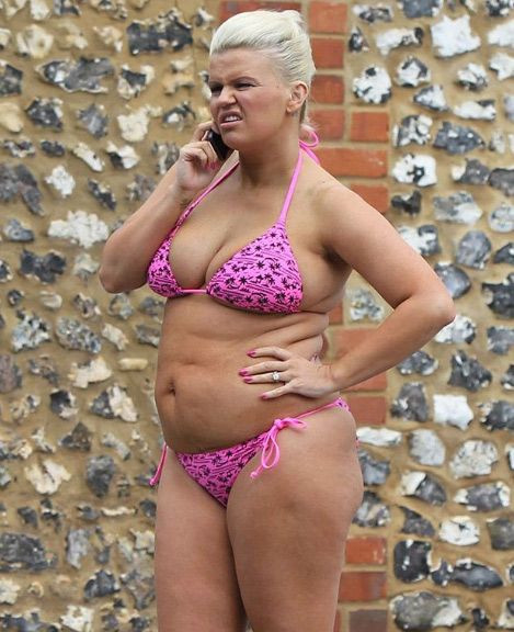 Kerry Katona 6 haftada 12 kilo verince bu hale geldi