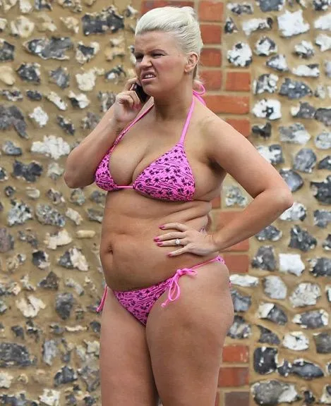 Kerry Katona 6 haftada 12 kilo verince bu hale geldi