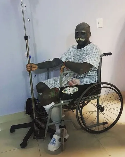 Mürekkep bağımlısı Adam cinsel organını aldırdı