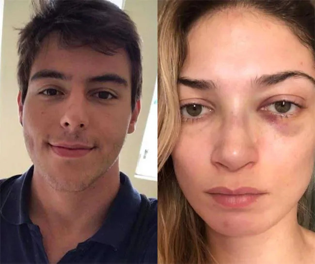 Cani erkek arkadaş kız arkadaşını kamera önünde dövdü