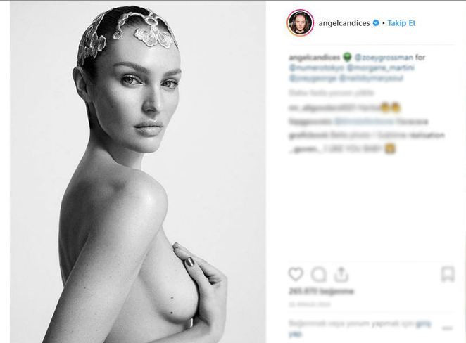 Candice Swanepoel doğum kilolarını nasıl verdi?