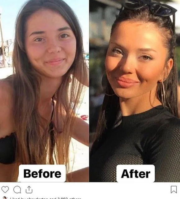 Sosyal medyada 10 years challenge çılgınlığı