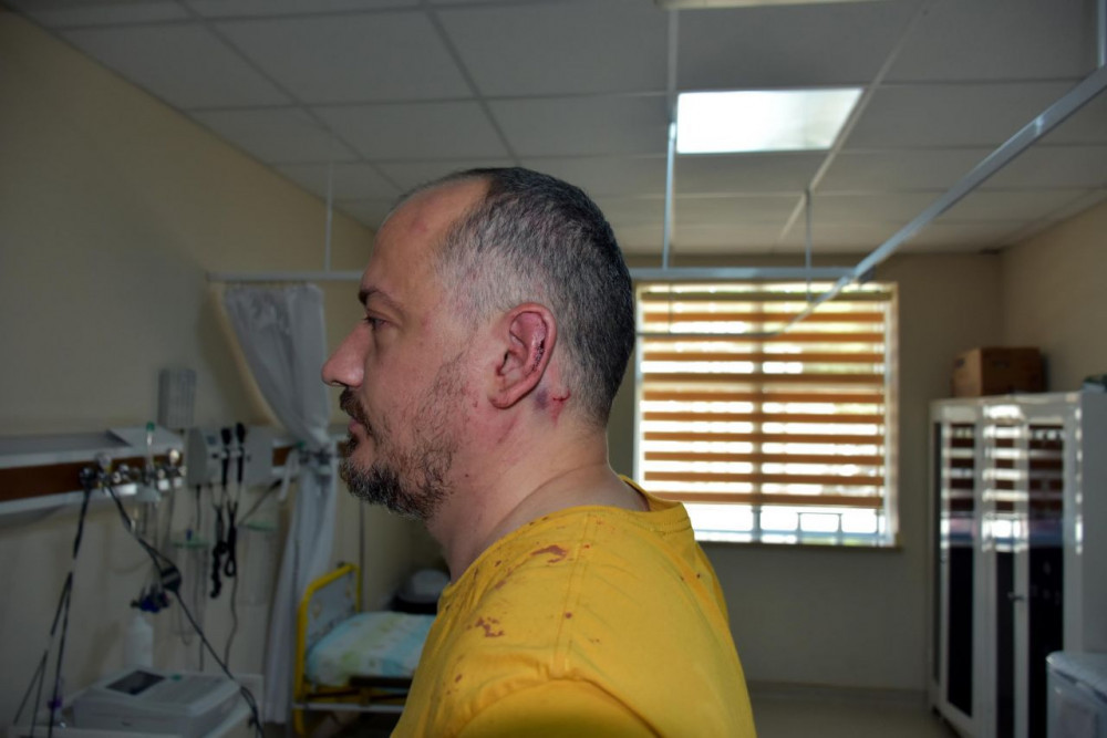 Gezgin Fatih Koparan 10 kişinin saldırısına uğradı: Defalarca 155'i aradım...
