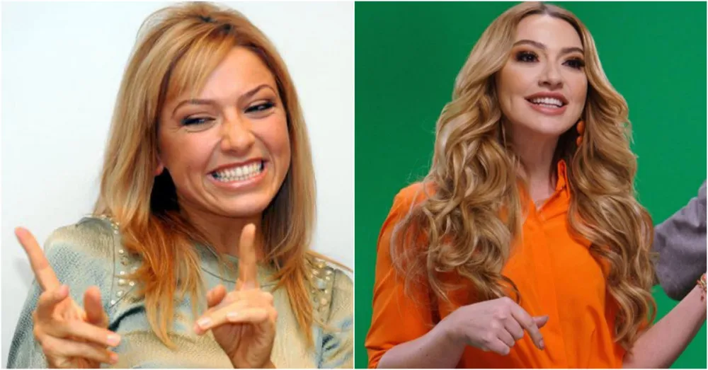 Sadece diş estetiğiyle bambaşka bir insana dönüşen ünlüler