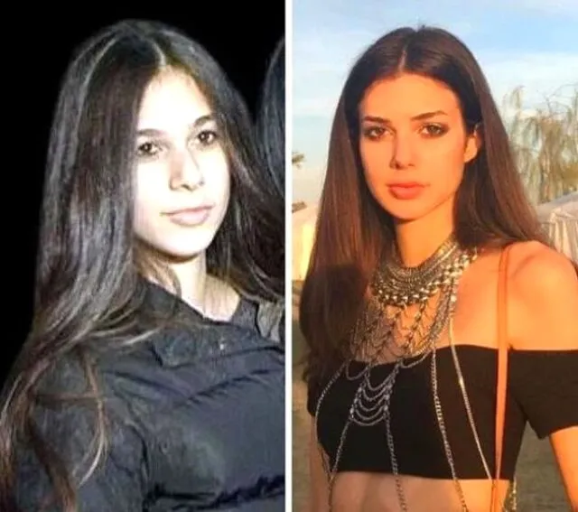 Deren Talu'nun estetiksiz görüntüsü görenleri şaşırttı!