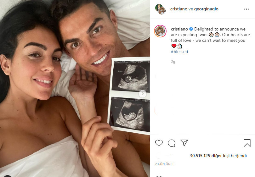 Cristiano Ronaldo İkiz Bebek Bekliyor