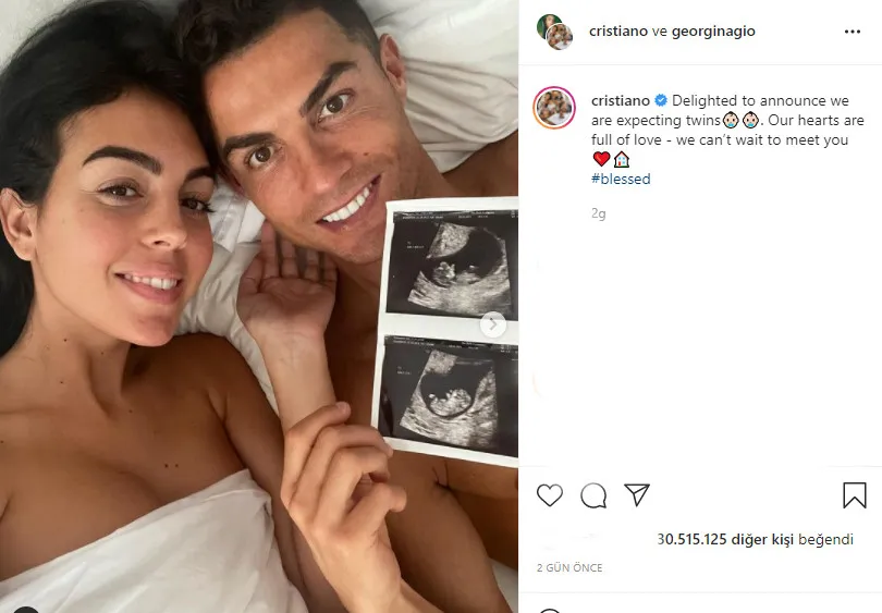 Cristiano Ronaldo İkiz Bebek Bekliyor