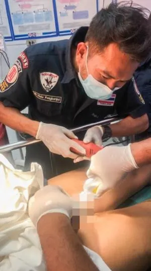 Cinsel Organı Büyüsün  Diye Demir Halka Taktı Hastanelik Oldu