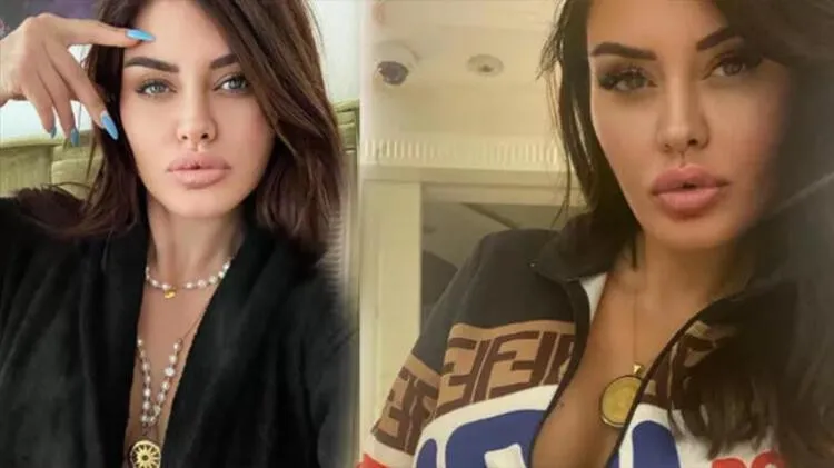 Ebru Polat Koranavirüse Yakalandı