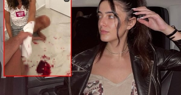 Şiddet Son Bulmuyor! İrem Ay  Eski Eşinden İşkence Gördüğü Anları Paylaştı