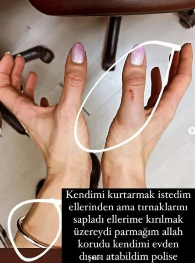 Kanlar İçindeki Fotoğraflara Özer Hurmacı'dan Yanıt: Hepsi Yalan!