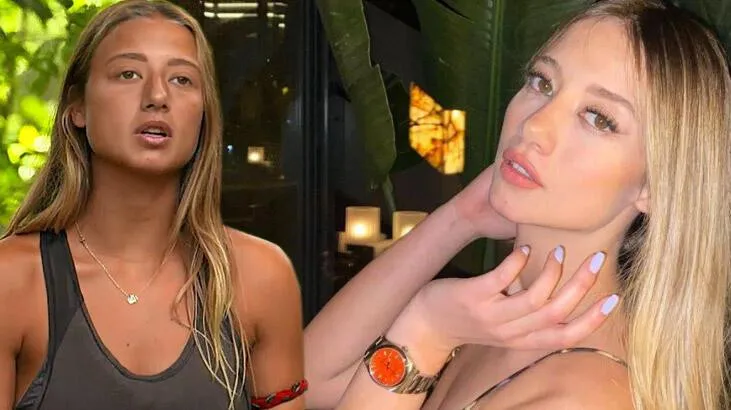 Aleyna Kalaycıoğlu Estetik Sorusuna Sinirlendi: Takma Kafana!