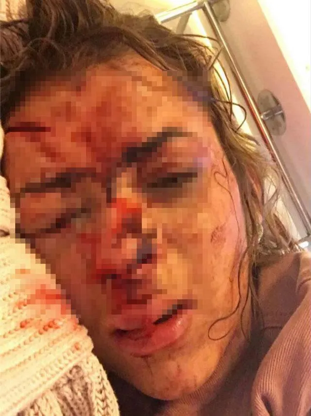 Sevgilisini Başka Kadınla Öpüşürken Yakaladı Üstüne Bir de Darp Edildi!