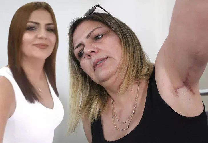 Estetik Yaptıran Kadın Hayatının Şokunu Yaşadı: Vücudumun Her Yeri Haritaya Döndü