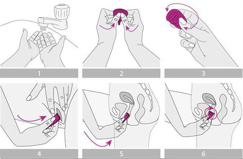 Menstrual kap nedir, nasıl kullanılır? - Resim: 1