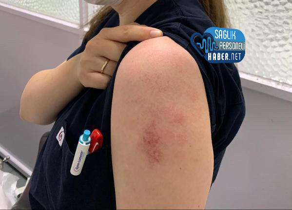 Suriyeli Hasta Yakını 2 Asistan Doktora Saldırdı - Resim: 2