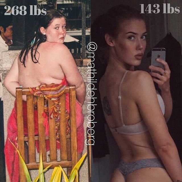 126 kiloluk şişman kız Mathilde 64 kiloya düştü, mankenlere taş çıkartıyor - Resim: 1