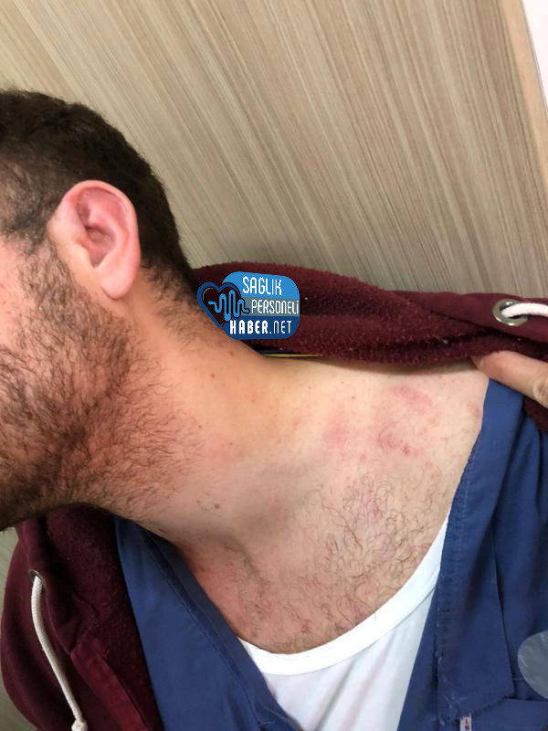 Suriyeli Hasta Yakını 2 Asistan Doktora Saldırdı - Resim: 1